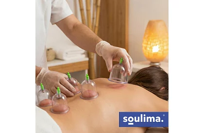 Set de cupe chinezești pentru ventuze fără foc – 12 bucăți