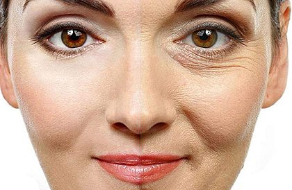 Aparat de lifting facial – Energy Beauty Bar