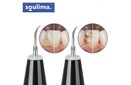 Detergent ultrasonic pentru îndepărtarea tartrului dentar + accesorii